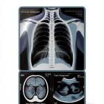 Medical Dictionary Medical Terms Made Clear Kindle-0